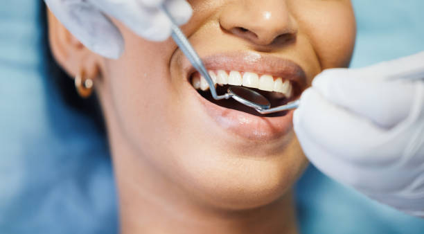 Best Emergency Dentist for Lost Fillings or Crowns in Niceville, FL